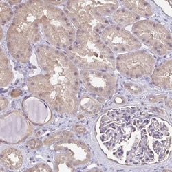 Invitrogen RBG1L Polyclonal Antibody 100 &mu;L; Unconjugated:Antibodies,