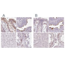 Invitrogen TMEM237 Polyclonal Antibody 100 &mu;L; Unconjugated:Antibodies,