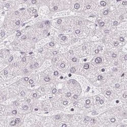 Invitrogen TMEM237 Polyclonal Antibody 100 &mu;L; Unconjugated:Antibodies,