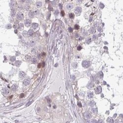 Invitrogen TMEM237 Polyclonal Antibody 100 &mu;L; Unconjugated:Antibodies,