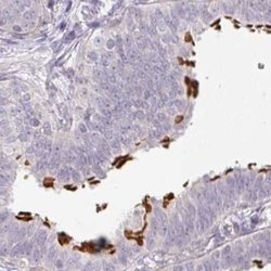 Invitrogen TMEM237 Polyclonal Antibody 100 &mu;L; Unconjugated:Antibodies,