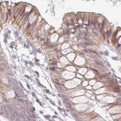 Invitrogen TMEM237 Polyclonal Antibody 100 &mu;L; Unconjugated:Antibodies,