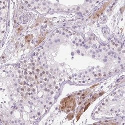 Invitrogen ZNF35 Polyclonal Antibody 100 &mu;L; Unconjugated:Antibodies,