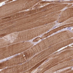 Invitrogen FAM65C Polyclonal Antibody 100 &mu;L | Buy Online | Invitrogen&trade; | Fisher Scientific