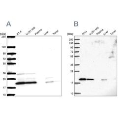 Invitrogen NDUFAF2 Polyclonal Antibody 100 &mu;L; Unconjugated:Anticuerpos
