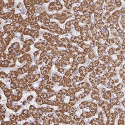Invitrogen TTC39B Polyclonal Antibody 100 &mu;L; Unconjugated:Antibodies,