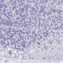 Invitrogen GLB1L2 Polyclonal Antibody 100 &mu;L; Unconjugated:Antibodies,