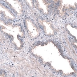 Invitrogen PTPRK Polyclonal Antibody 100 &mu;L; Unconjugated:Antibodies,