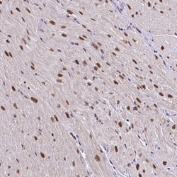 Invitrogen ABCA9 Polyclonal Antibody 100 &mu;L; Unconjugated:Antibodies,