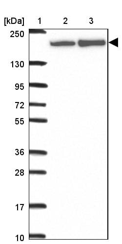 Invitrogen ABCA9 Polyclonal Antibody 100 &mu;L; Unconjugated:Antibodies,