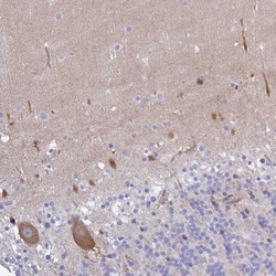Invitrogen Carbonic Anhydrase X Polyclonal Antibody 100 &mu;L; Unconjugated:Antibodies,