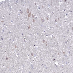 Invitrogen Carbonic Anhydrase X Polyclonal Antibody 100 &mu;L; Unconjugated:Antibodies,
