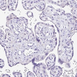 Invitrogen Carbonic Anhydrase X Polyclonal Antibody 100 &mu;L; Unconjugated:Antibodies,