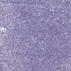 Invitrogen Carbonic Anhydrase X Polyclonal Antibody 100 &mu;L; Unconjugated:Antibodies,