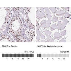 SMC5 Polyclonal Antibody, Invitrogen 100 &mu;L; Unconjugated:Antibodies,