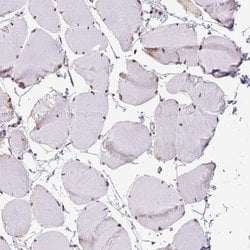 SMC5 Polyclonal Antibody, Invitrogen 100 &mu;L; Unconjugated:Antibodies,