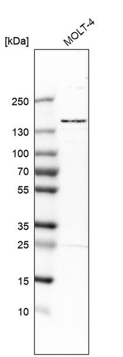 SMC5 Polyclonal Antibody, Invitrogen 100 &mu;L; Unconjugated:Antibodies,
