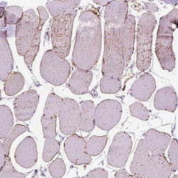 Invitrogen TRIM72 Polyclonal Antibody 100 &mu;L; Unconjugated:Antibodies,