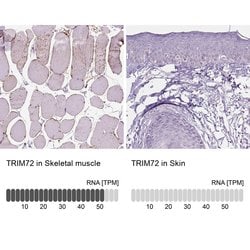 Invitrogen TRIM72 Polyclonal Antibody 100 &mu;L; Unconjugated:Antibodies,