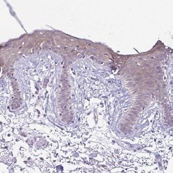 Invitrogen Desmoplakin Polyclonal Antibody 100 &mu;L; Unconjugated:Antistoffer