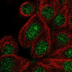 Invitrogen DENND2C Polyclonal Antibody 100 &mu;L; Unconjugated:Antibodies,