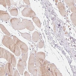 Invitrogen DENND2C Polyclonal Antibody 100 &mu;L; Unconjugated:Antibodies,