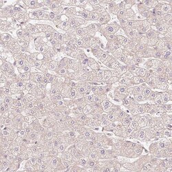 Invitrogen SLC29A3 Polyclonal Antibody 100 &mu;L; Unconjugated:Antibodies,