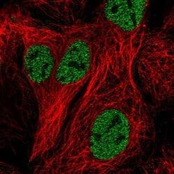 Invitrogen ZNF607 Polyclonal Antibody 100 &mu;L; Unconjugated:Antibodies,