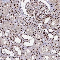 Invitrogen ZNF607 Polyclonal Antibody 100 &mu;L; Unconjugated:Antibodies,