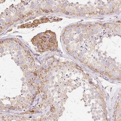 Invitrogen RPS17 Polyclonal Antibody 100 &mu;L; Unconjugated:Antibodies,