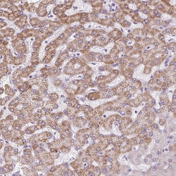 Invitrogen TMEM170A Polyclonal Antibody 100 &mu;L; Unconjugated:Antibodies,