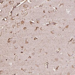 Invitrogen LRTM2 Polyclonal Antibody 100 &mu;L; Unconjugated:Antibodies,
