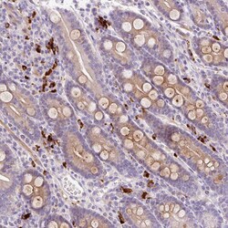 Invitrogen LHFPL5 Polyclonal Antibody 100 &mu;L; Unconjugated:Antibodies,