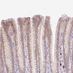 Invitrogen LHFPL5 Polyclonal Antibody 100 &mu;L; Unconjugated:Antibodies,