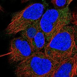 Invitrogen CCDC28A Polyclonal Antibody 100 &mu;L; Unconjugated:Antibodies,