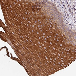 Invitrogen CCDC28A Polyclonal Antibody 100 &mu;L; Unconjugated:Antibodies,