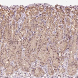 Invitrogen TMEM170B Polyclonal Antibody 100 &mu;L; Unconjugated:Antibodies,
