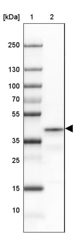 Invitrogen PRRT1 Polyclonal Antibody 100 &mu;L; Unconjugated:Antibodies,