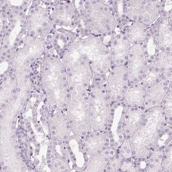 Invitrogen PRM1 Polyclonal Antibody 100 &mu;L | Buy Online | Invitrogen&trade; | Fisher Scientific