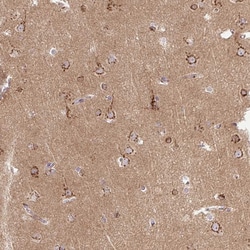 Invitrogen MSMP Polyclonal Antibody 100 &mu;L; Unconjugated:Antibodies,
