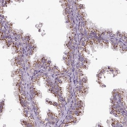 Invitrogen MSMP Polyclonal Antibody 100 &mu;L; Unconjugated:Antibodies,