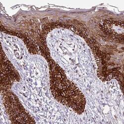 Invitrogen MSMP Polyclonal Antibody 100 &mu;L; Unconjugated:Antibodies,