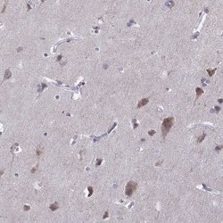 Invitrogen VGF Polyclonal Antibody 100 &mu;L; Unconjugated:Antibodies,