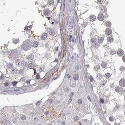 Invitrogen VGF Polyclonal Antibody 100 &mu;L; Unconjugated:Antibodies,