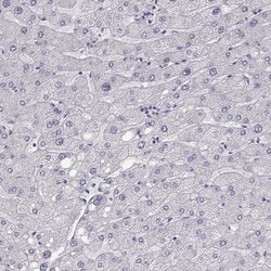 Invitrogen Cytokeratin 31 Polyclonal Antibody 100 &mu;L; Unconjugated:Antibodies,