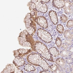 Invitrogen SLC25A40 Polyclonal Antibody 100 &mu;L; Unconjugated:Antibodies,