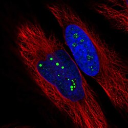 Invitrogen USP35 Polyclonal Antibody 100 &mu;L; Unconjugated:Antibodies,