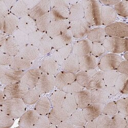 Invitrogen USP35 Polyclonal Antibody 100 &mu;L; Unconjugated:Antibodies,