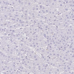 Invitrogen TMEM79 Polyclonal Antibody 100 &mu;L; Unconjugated:Antibodies,