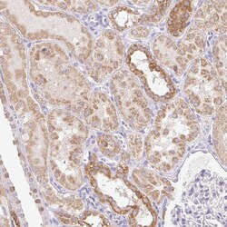 Invitrogen ITPK1 Polyclonal Antibody 100 &mu;L; Unconjugated:Antibodies,